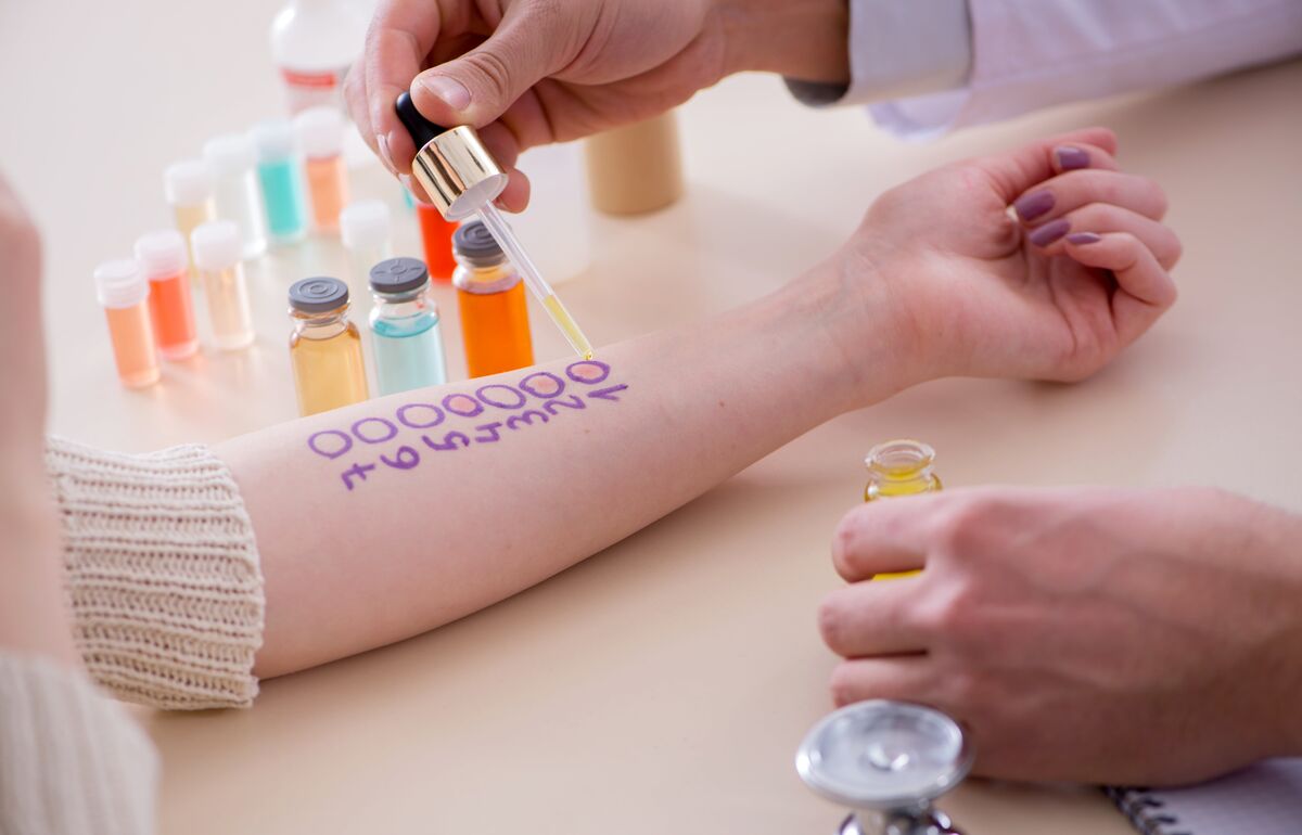 https://stock.adobe.com/at/images/doctor-testing-allergy-reaction-of-patient-in-hospital/204182964 Immuntherapie und Covid-Impfung: Kein Grund zur Sorge! / Bild: Adobe Stock