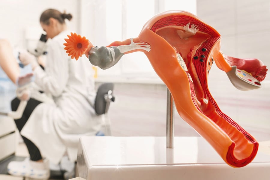 Endometriose – private Krankenversicherung Österreich